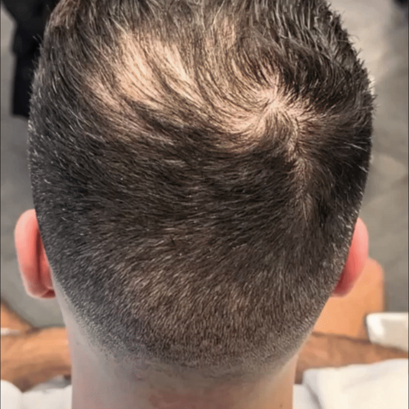 HairSync™ Premium Conceal Powder for Thinning Roots