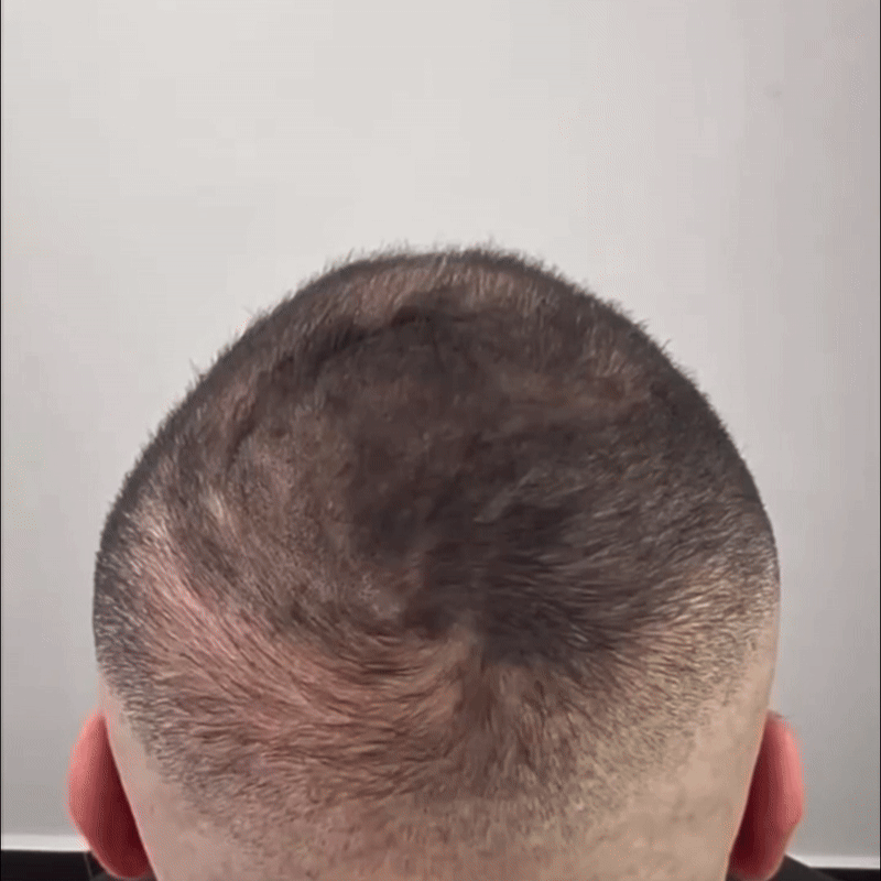 HairSync™ Premium Conceal Powder for Thinning Roots