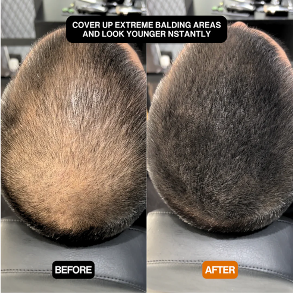 HairSync™ Premium Conceal Powder for Thinning Roots